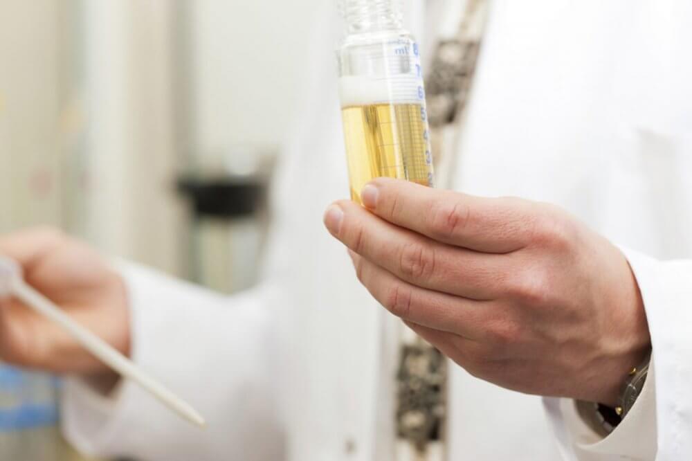 Анализы пива